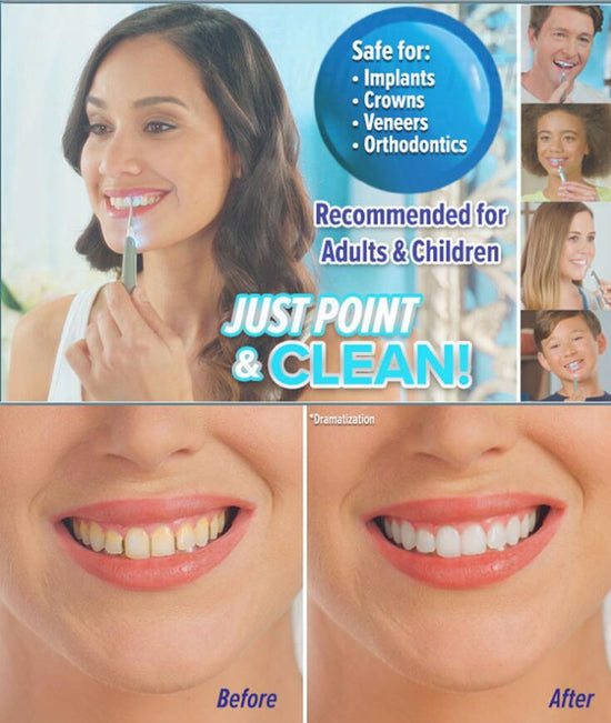 Kit Blanchiment Dentaire Professionnel – Dental Cleaner Teeth Whitening